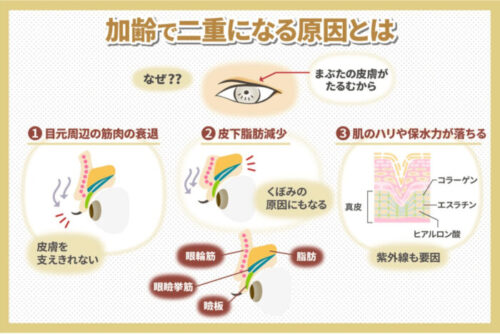 大沢たかおの目は整形？加齢が原因？